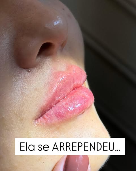 Carrossel_AdRecon-4.jpg