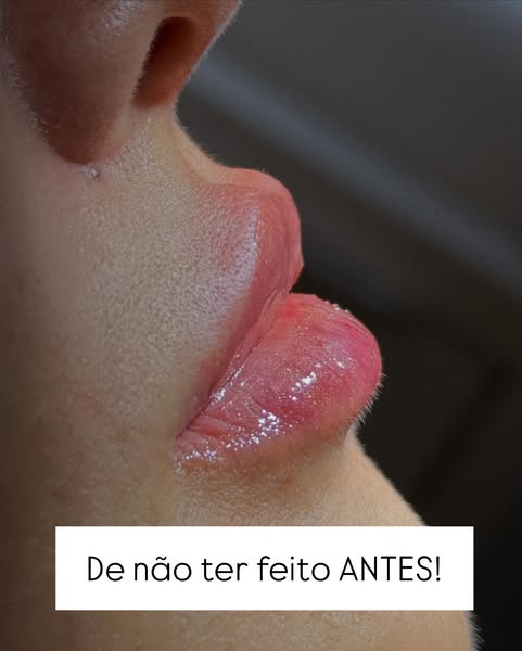 Carrossel_AdRecon.jpg